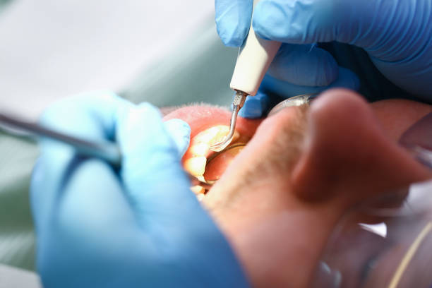 Best Emergency Dentist for Knocked-Out Tooth in Wentworth, NC